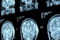 Brain Cells Linked to Male Aggression and Sex Drive