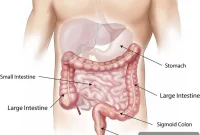 Gut Microbiome in Huntington’s Disease Identified as Drug Target