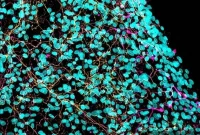New Support System for Axons Reveals Neurodegeneration Target