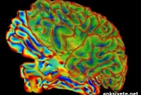 Menstrual Seizures Could Indicate Drug-Resistant Epilepsy
