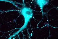Researchers Target Gene Linked to Alzheimer’s Disease