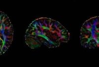 Binge Drinking Makes the Brain Work Harder to Feel Empathy