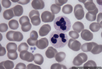Discovery Reveals How Blood’s Fountain of Youth Is Protected