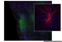 Learned Taste Aversion: How It Reshapes Brain and Behavior