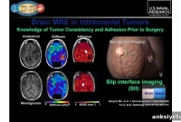 Noninvasive Imaging for Traumatic Brain Injury Detection