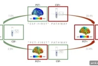 Genetic Variants Linked to Alzheimer’s Diagnosis