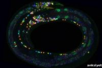 New Multicolor Brain Atlas Maps Cellular Diversity