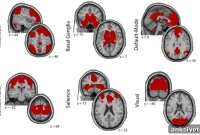 New Study Reveals How Traumatic Stress Alters the Brain