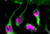 Activating Neural Stem Cells for Brain Regeneration
