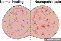 New Cell Type Linked to Chronic Pain and Inflammation