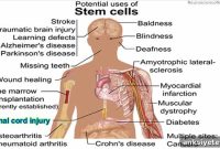 Neural Stem Cells Restore Axons After Severe Spinal Cord Injury
