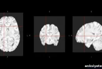 Human Brains Share a Genetic Blueprint and Complex Biochemistry
