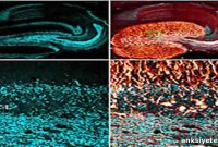 Study Finds Biological Mechanism Triggers Epileptic Seizures