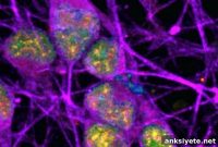New DNA Damage Hotspots Identified in Neurons