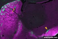 Genetic Mutations Linked to Severe Repetitive Behaviors