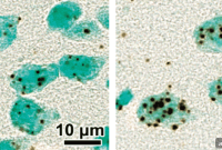 Neurotransmitter Transporter Imbalance Linked to Schizophrenia