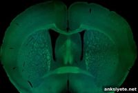 Sex Differences in Autism Genetics: Male vs Female Risk