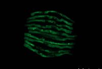 Study Links Gut Microbiome to Alzheimer’s and Parkinson’s
