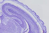 Gene Mutation Slows Neurons, Impairing Brain Function