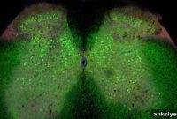 Loss of Spinal Cord Connections May Trigger ALS