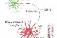 Researchers Identify Immune Cell Behavior That Fuels Alzheimer’s
