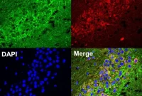 How Cannabinoid Pathways Influence Psychiatric Disorders