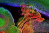 Immature Gut Microbiota and Barriers Fuel Neonatal Meningitis