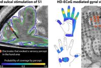How Brain Implant Electrodes Evoke the Sense of Touch