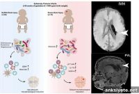 How the Gut Microbiome Shapes Brain Development