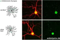 Dendritic Pruning: How Neurons Remodel Their Connections