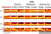 Monkeys, Guinea Pigs and Humans Share Brain Responses to Speech