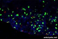 New Immune Cell May Trigger Brain Inflammation in MS