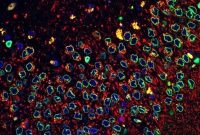 Researchers Identify Protein Behind Parkinson’s Neuron Loss