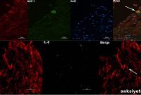 Are Dead Bacterial Fragments Causing Lingering Lyme Symptoms?