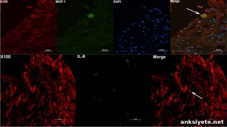 featured 80171