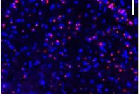 Brain Iron Buildup Linked to Cognitive Decline in Aging