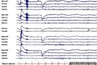 Brainwave Training Predicts Mind Wandering via Cognitive Control