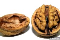 Brain Study Reveals Link Between Pain and Food Choices