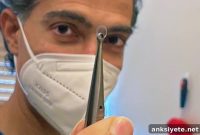 Window System Enables Long-Term Brain Activity Research