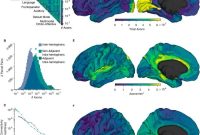 Few Long Range Connections Tie Distant Brain Regions