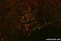 Researchers Search for Neurons That Trigger Alcohol Withdrawal