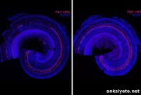 Regenerative Therapy to Reverse Hearing Loss