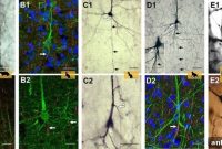 Primate vs Non-Primate Neuron Architecture: Key Differences