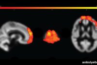 Brain Changes Tied to Chronic Pain in Gulf War Veterans