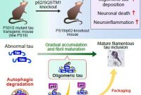 Protecting the Brain From Dementia-Causing Protein Aggregates