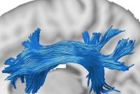 GPU Accelerated Mapping of Human Brain Connectivity