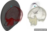 Brain Ultrasound Imaging: Mapping the Mind with Sound