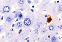 Live Imaging Reveals Key Moments of Cell Death