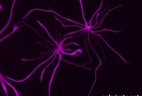 How Astrocytes Influence Brain Disorders
