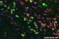 How Brain Cells Drive Junk Food Cravings